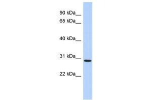 WB Suggested Anti-SERTAD2 Antibody Titration:  0. (SERTAD2 anticorps  (N-Term))