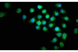 Immunofluorescence staining of A549 cells with ABIN7145207 at 1:266, counter-stained with DAPI. (Survivin anticorps  (AA 1-130))