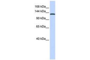 Image no. 1 for anti-Valyl-tRNA Synthetase (VARS) (C-Term) antibody (ABIN6740955) (VARS anticorps  (C-Term))