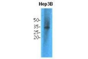 Western Blotting (WB) image for anti-Thiopurine S-Methyltransferase (TPMT) antibody (ABIN781550) (TPMT anticorps)