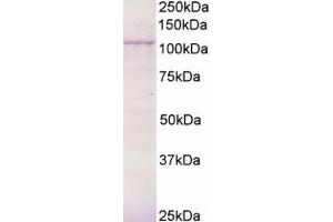 Western Blotting (WB) image for anti-Breast Cancer Anti-Estrogen Resistance 3 (BCAR3) (C-Term) antibody (ABIN2465465) (BCAR3 anticorps  (C-Term))