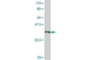 Western Blot detection against Immunogen (37. (SMC1A anticorps  (AA 366-465))