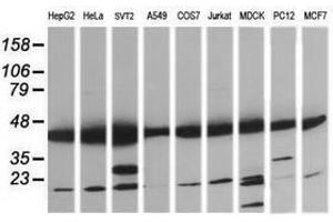 Image no. 8 for anti-Mitogen-Activated Protein Kinase Kinase 1 (MAP2K1) antibody (ABIN1499385) (MEK1 anticorps)
