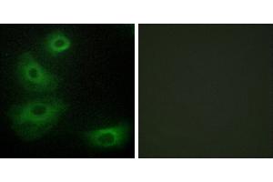 Peptide - +Immunohistochemistry analysis of paraffin-embedded human brain tissue, using 5-HT-1B antibody. (5HT1B Receptor anticorps  (Internal Region))