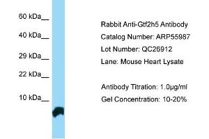 Western Blotting (WB) image for anti-General Transcription Factor IIH, Polypeptide 5 (GTF2H5) (N-Term) antibody (ABIN2786467) (GTF2H5 anticorps  (N-Term))