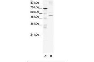 Image no. 1 for anti-Autoimmune Regulator (AIRE) (AA 76-125) antibody (ABIN203264) (AIRE anticorps  (AA 76-125))