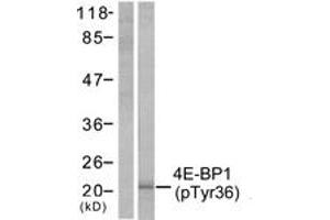 Western Blotting (WB) image for anti-Eukaryotic Translation Initiation Factor 4E Binding Protein 1 (EIF4EBP1) (pThr36) antibody (ABIN2888349) (eIF4EBP1 anticorps  (pThr36))