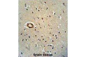 Immunohistochemistry (IHC) image for anti-CWC22 Spliceosome-Associated Protein Homolog (CWC22) antibody (ABIN2995841) (CWC22 anticorps)