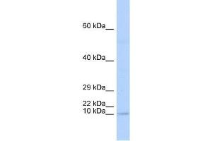 TAL2 antibody used at 1. (TAL2 anticorps  (N-Term))