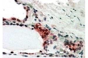 Immunohistochemistry (IHC) image for anti-Casein beta (CSN2) antibody (ABIN5859099) (CSN2 anticorps)