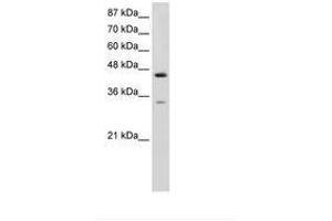 Image no. 1 for anti-Splicing Factor 3b, Subunit 4, 49kDa (SF3B4) (AA 151-200) antibody (ABIN6736239) (SF3B4 anticorps  (AA 151-200))