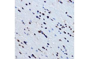 Immunohistochemistry of paraffin-embedded mouse brain using TDP-43/TARDB Rabbit pAb  at dilution of 1:500 (40x lens). (TARDBP anticorps  (AA 1-100))