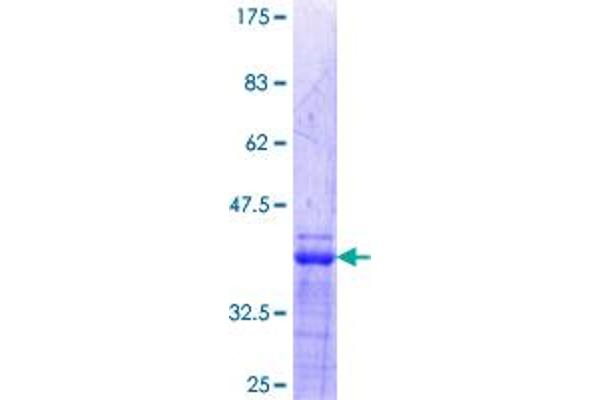 ETS1 Protein (AA 173-272) (GST tag)