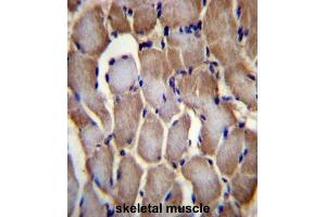 Immunohistochemistry (IHC) image for anti-Selenoprotein N, 1 (SEPN1) antibody (ABIN2996755) (SEPN1 anticorps)