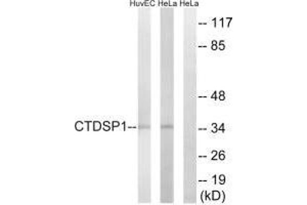 CTDSP1 anticorps  (N-Term)