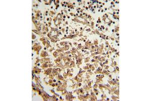 Immunohistochemistry (IHC) image for anti-Telomerase Reverse Transcriptase (TERT) antibody (ABIN2997736) (TERT anticorps)