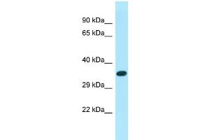 Western Blotting (WB) image for anti-XK, Kell Blood Group Complex Subunit-Related Family, Member 6 (XKR6) (C-Term) antibody (ABIN2790601) (XKR6 anticorps  (C-Term))