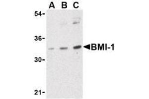 Image no. 1 for anti-BMI1 Polycomb Ring Finger Oncogene (BMI1) (Internal Region) antibody (ABIN200102) (BMI1 anticorps  (Internal Region))