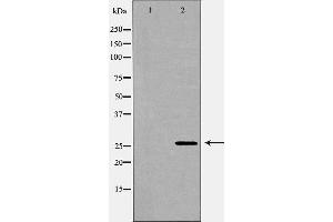 Western blot analysis of extracts of  hela , using LGALS3 antibody. (Galectin 3 anticorps  (Internal Region))