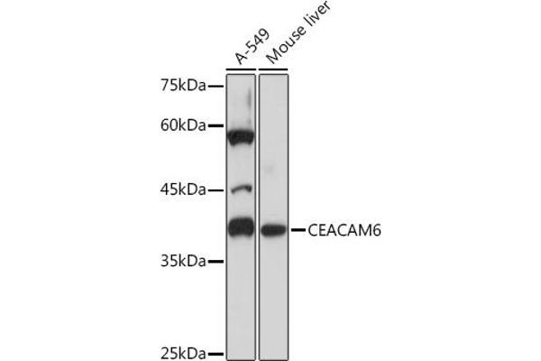 CEACAM6 anticorps