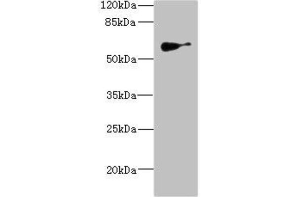 SLC22A8 anticorps  (AA 473-542)