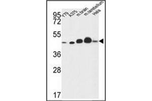 Western blot analysis of NDUFS2 Antibody (Center) in Y79,A375,Hela cell line and mouse brain,cerebellum tissue lysates (35ug/lane). (NDUFS2 anticorps  (Middle Region))