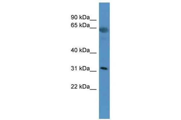 OR2T29 anticorps  (C-Term)