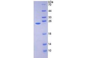 SDS-PAGE analysis of AMBP Protein. (AMBP Protéine)