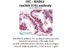 Image no. 1 for anti-RAD52 Homolog (S. Cerevisiae) (RAD52) (AA 360-375) antibody (ABIN1738702) (RAD52 anticorps  (AA 360-375))