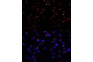Immunofluorescence analysis of C6 cells using GOLG antibody (ABIN7267496) at dilution of 1:100. (GOLGA5 anticorps  (AA 1-300))