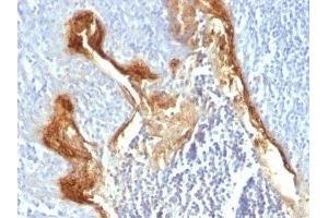 Image no. 1 for anti-Involucrin (IVL) antibody (ABIN6164814) (Involucrin anticorps)