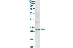 Western Blotting (WB) image for anti-Twist Homolog 1 (Drosophila) (TWIST1) (AA 100-202) antibody (ABIN563296)