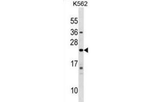 Western Blotting (WB) image for anti-Interferon, alpha 10 (IFNa10) antibody (ABIN2999555) (IFNA10 anticorps)