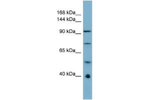 Host:  Rabbit  Target Name:  RBBP6  Sample Type:  ACHN Whole cell lysates  Antibody Dilution:  1. (RBBP6 anticorps  (N-Term))