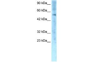 WB Suggested Anti-ZNF500 Antibody Titration: 0. (ZNF500 anticorps  (Middle Region))