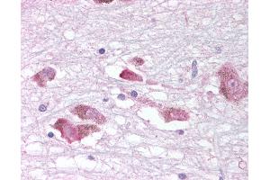 Anti-MCHR1 antibody IHC of human brain, substantia nigra. (MCHR1 anticorps  (C-Term))