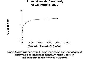 Image no. 2 for anti-Annexin A5 (ANXA5) (AA 1-320) antibody (ABIN5564834) (Annexin V anticorps  (AA 1-320))