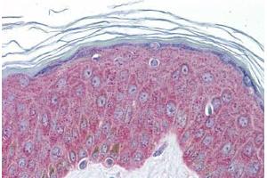 Human Skin: Formalin-Fixed, Paraffin-Embedded (FFPE) (IL-33 anticorps  (AA 36-85))