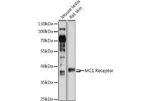 Western blot analysis of extracts of various cell lines, using MC1 Receptor antibody (ABIN6132878, ABIN6143610, ABIN6143612 and ABIN6217539) at 1:1000 dilution. (MC1 Receptor anticorps  (AA 1-80))