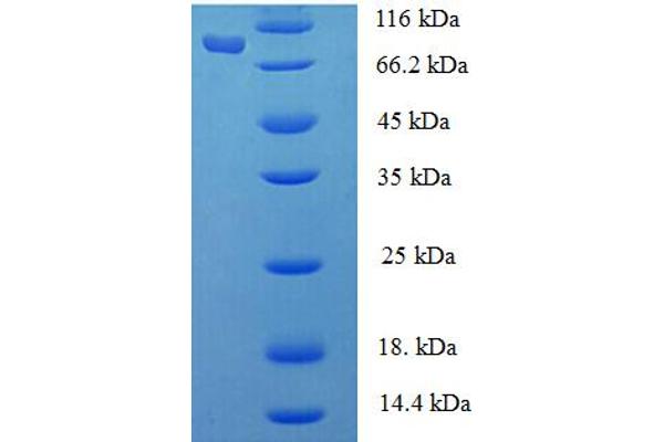 Phenylalanyl-tRNA Synthetase, alpha Subunit (FARSA) (AA 2-508) protein (His-SUMO Tag)