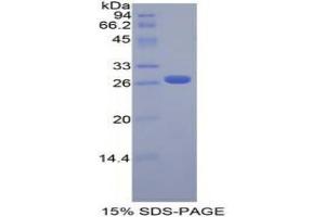 SDS-PAGE analysis of Mouse FGFRL1 Protein. (FGFRL1 Protéine)