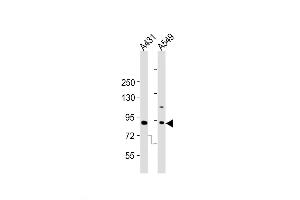 Western Blot at 1:2000 dilution Lane 1: A431 whole cell lysates Lane 2: A549 whole cell lysates Lysates/proteins at 20 ug per lane. (DNMT3B anticorps  (AA 389-417))
