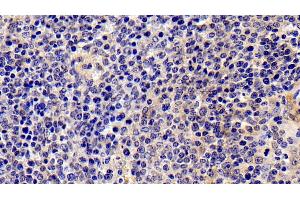 Detection of IL2Ra in Porcine Spleen Tissue using Polyclonal Antibody to Interleukin 2 Receptor Alpha (IL2Ra) (CD25 anticorps  (AA 22-245))