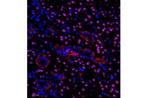 Immunofluorescence of paraffin embedded rat kidney using pax2 (ABIN7074974) at dilution of 1:600 (350x lens) (PAX2A anticorps)