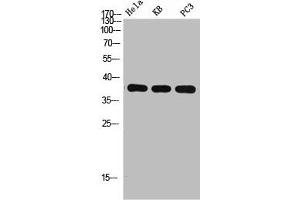 Western Blot analysis of HELA KB PC-3 using p38 Polyclonal Antibody. (MAPK14 anticorps  (C-Term))
