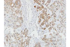 IHC-P Image Immunohistochemical analysis of paraffin-embedded A549 xenograft, using AHA-1, antibody at 1:100 dilution. (AHSA1 anticorps  (Center))