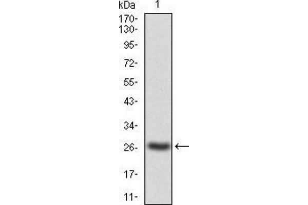 JAK2 anticorps  (AA 745-955)