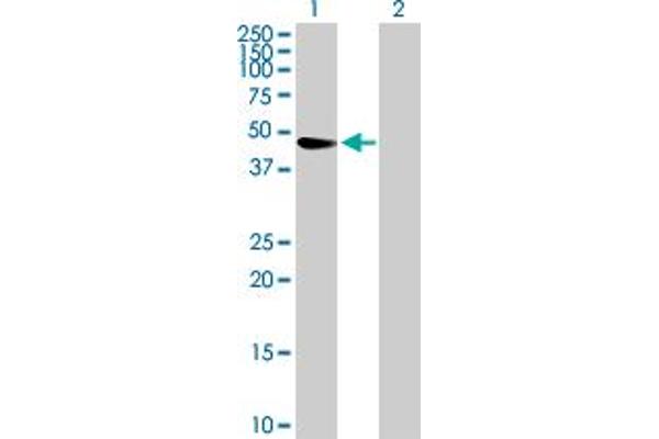 TRIM47 anticorps  (AA 1-400)