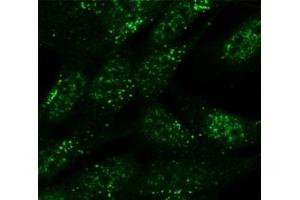 SNX1 antibody (5ug/ml) staining of formaldehyde-fixed SH5Y5Y cells detected with Alexa Fluor 488 in confocal microscopy. (Sorting Nexin 1 anticorps)