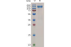 FLT1 Protein (AA 27-756) (His tag)